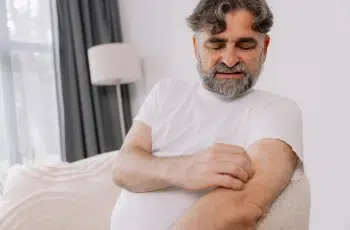 Understanding Eczema – Types, Causes, Symptoms, And Treatment