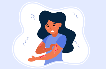 Understanding Eczema – Types, Causes, Symptoms, And Treatment