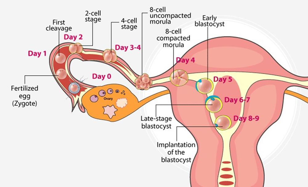 Understanding female infertility