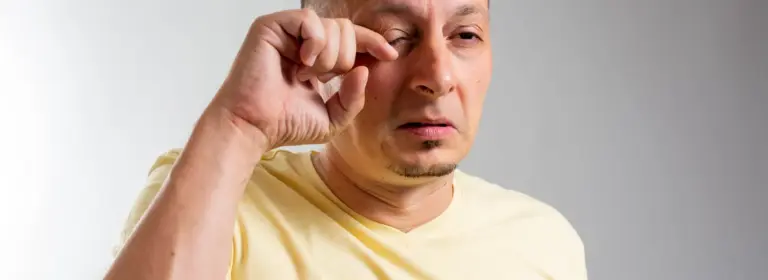 Allergic conjunctivitis management at home according to a GP