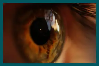 Stye self-care - Home remedies & treatment 
