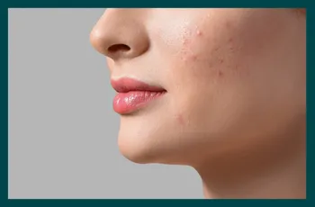 White spots on skin - Possible causes and next steps 