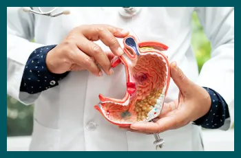 Understanding gastro-oesophageal reflux disease (GORD) in adults