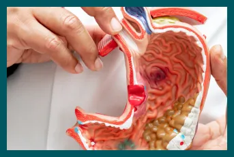 foods neutralise stomach acid